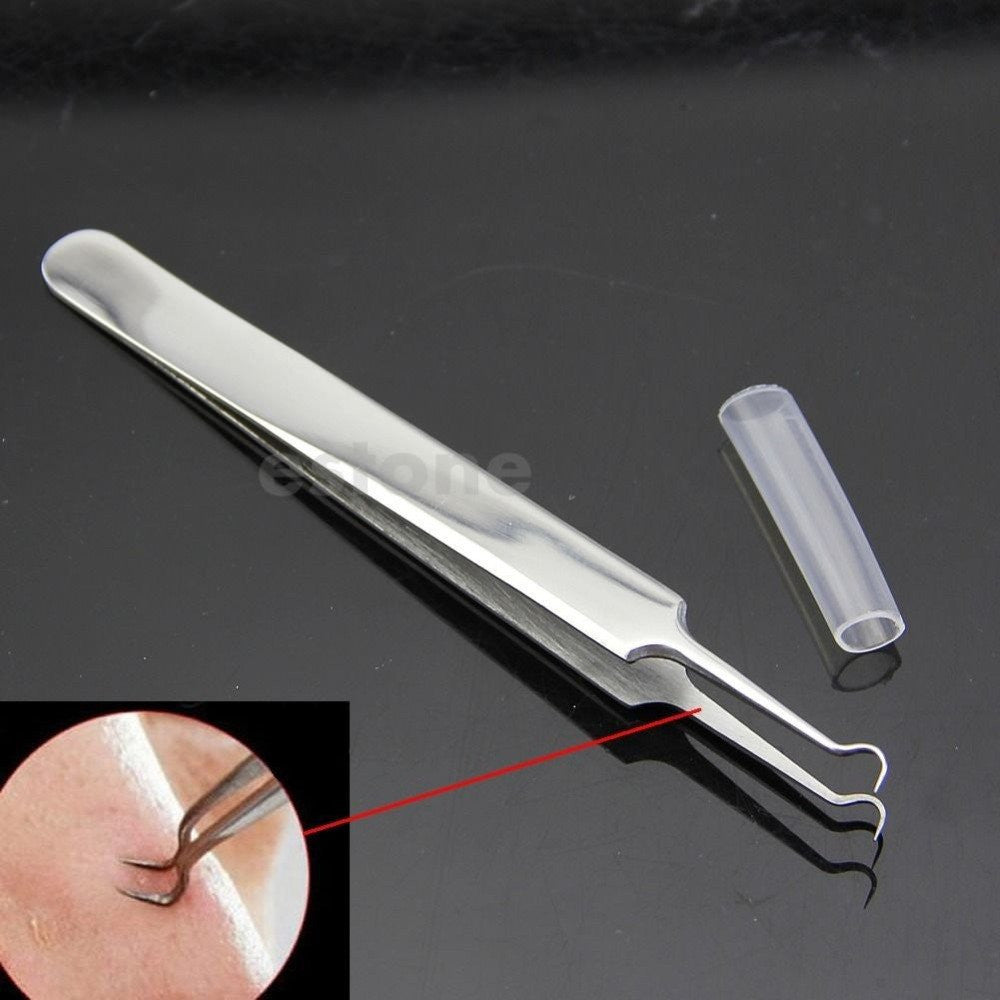Blackhead and Comedone Acne Extractor